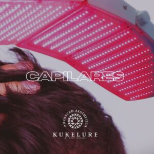 Capilares